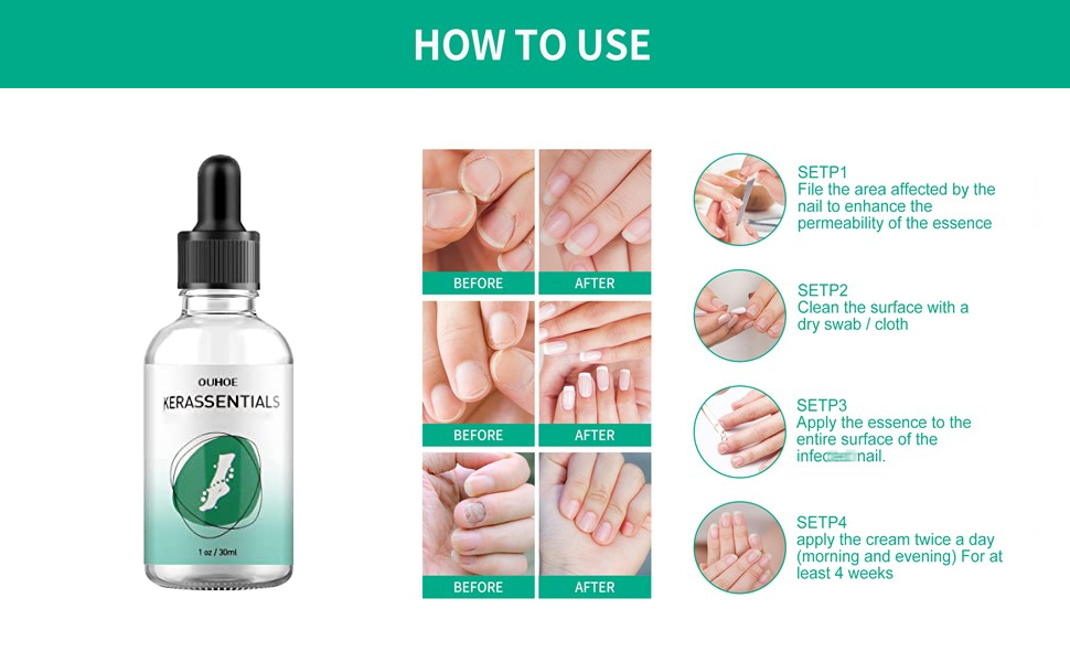 Kerassentials™ Reviews 2025: Is’t Legit or a Scam? Find Now. 14 Kerassentials